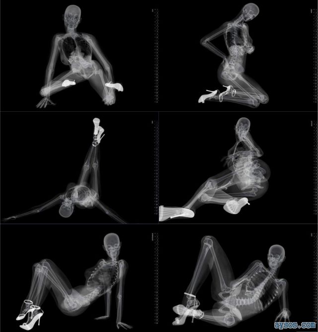 Babe in heels xray picture