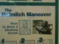 The Heimlich Maneuver Funny Style