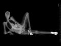 Xray Model in Heels